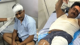Beed News: बीडमध्ये RTI कार्यकर्त्यावर 8 ते 10 जणांचा सशस्त्र हल्ला; पाय तोडून अमानुष छळ, कारण काय?