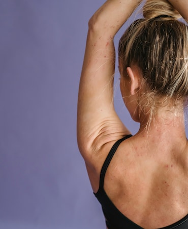 8 Must-Haves For Strawberry Skin