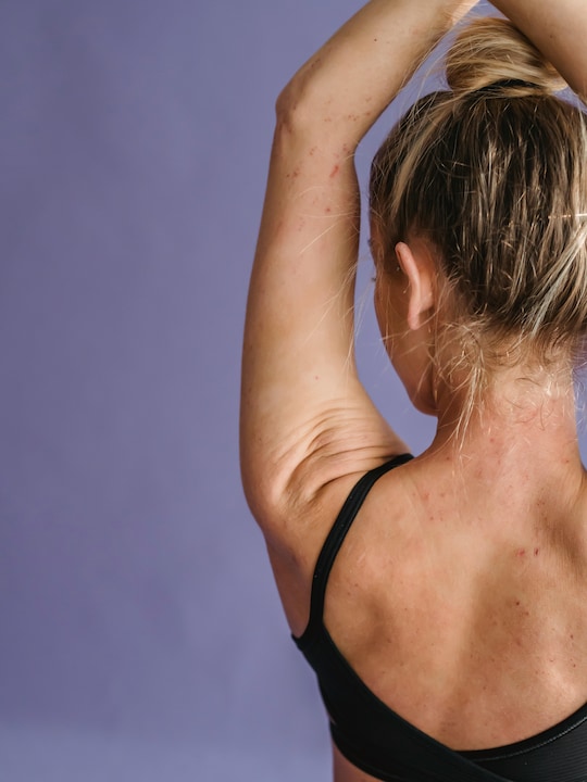 8 Must-Haves For Strawberry Skin