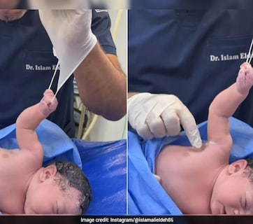 पैदा होते ही डॉक्टर से भिड़ गया नन्हा 'बाहुबली', हाथ ऐसा पकड़ा कि 2 करोड़ लोग बोले- क्यूट!