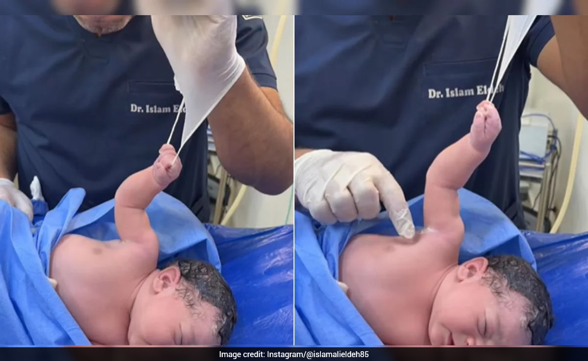 पैदा होते ही डॉक्टर से भिड़ गया नन्हा 'बाहुबली', हाथ ऐसा पकड़ा कि 2 करोड़ लोग बोले- क्यूट!