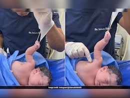 पैदा होते ही डॉक्टर से भिड़ गया नन्हा 'बाहुबली', हाथ ऐसा पकड़ा कि 2 करोड़ लोग बोले- क्यूट!