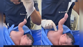 पैदा होते ही डॉक्टर से भिड़ गया नन्हा 'बाहुबली', हाथ ऐसा पकड़ा कि 2 करोड़ लोग बोले- क्यूट!