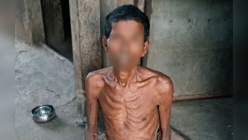 दिव्यांग बेटी के साथ पिता की हैवानियत: प्रेग्नेंसी से खुला राज, मां की शिकायत पर आरोपी गिरफ्तार