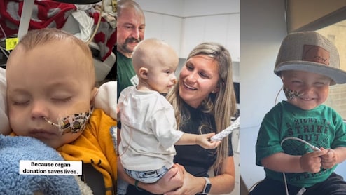 स्टेज-4 लिवर कैंसर से जंग जीत गया मासूम, मौसी बनीं फरिश्ता, अपना लिवर देकर बचाई जान