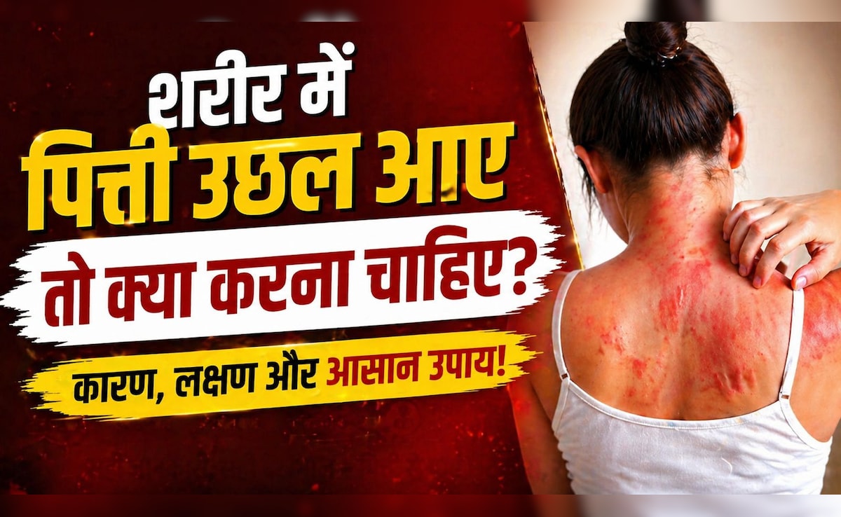 अचानक शरीर पर पित्ती उछल आए तो क्या करें? घबराएं नहीं, ये आसान उपाय तुरंत देंगे राहत!