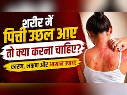 अचानक शरीर पर पित्ती उछल आए तो क्या करें? घबराएं नहीं, ये आसान उपाय तुरंत देंगे राहत!