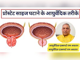 अनुभव&zwj;ी आयुर्वेद एक्&zwj;सपर्ट का दावा, ये आयुर्वेदिक उपाय कम कर सकते हैं बढ़ा प्रोस्टेट, जान लें घरेलू इलाज और प्रोस्टेट साइज घटाने के तरीके