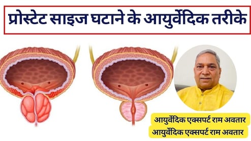 अनुभव&zwj;ी आयुर्वेद एक्&zwj;सपर्ट का दावा, ये आयुर्वेदिक उपाय कम कर सकते हैं बढ़ा प्रोस्टेट, जान लें घरेलू इलाज और प्रोस्टेट साइज घटाने के तरीके