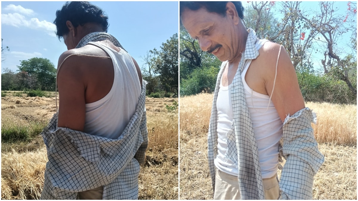 तेंदुए के हमले में घायल किसान तुलसीराम की जान बाल-बाल बची.