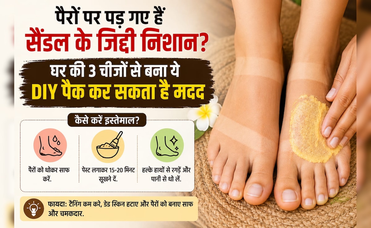 पैरों पर पड़ गए हैं सैंडल के जिद्दी निशान? घर की 3 चीजों से बना ये DIY पैक कर सकता है मदद