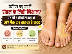 पैरों पर पड़ गए हैं सैंडल के जिद्दी निशान? घर की 3 चीजों से बना ये DIY पैक कर सकता है मदद