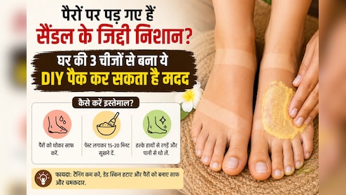 पैरों पर पड़ गए हैं सैंडल के जिद्दी निशान? घर की 3 चीजों से बना ये DIY पैक कर सकता है मदद