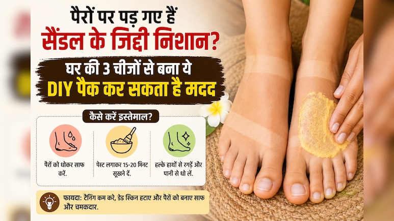 पैरों पर पड़ गए हैं सैंडल के जिद्दी निशान? घर की 3 चीजों से बना ये DIY पैक कर सकता है मदद