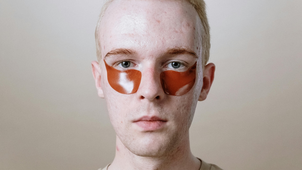 Best Acne Patches For Clear Skin: Top 7 Picks For Faster Pimple Healing