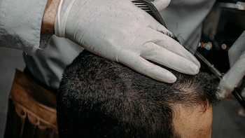 Lashkar Terrorist Goes For Hair Transplant After Infiltrating To Set Up Sleeper Bases In India