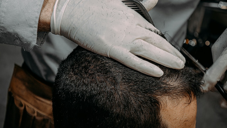 Lashkar Terrorist Goes For Hair Transplant After Infiltrating To Set Up Sleeper Bases In India