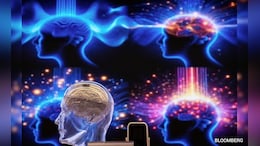 Why Brain Implants Are More Than A Sci-Fi Fantasy