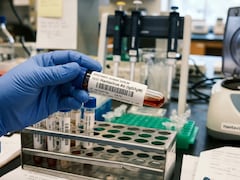 Hantavirus Not Mutating To Spread Faster, Experts Reassure Public