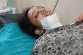 बांसवाड़ा: सिरफिरे युवक ने घर में घुसकर महिला पर किया ब्लेड से जानलेवा हमला, शरीर पर आए 25 टांके