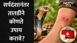 Snake Bite: सर्पदंशानंतर 10 मिनिटांची ही चूक ठरेल मृत्यूचे कारण, सर्वात आधी काय करावे? वाचा तज्ज्ञांचे 5 मुद्दे