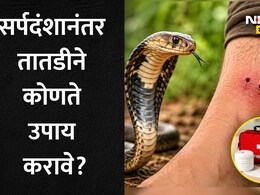 Snake Bite: सर्पदंशानंतर 10 मिनिटांची ही चूक ठरेल मृत्यूचे कारण, सर्वात आधी काय करावे? वाचा तज्ज्ञांचे 5 मुद्दे