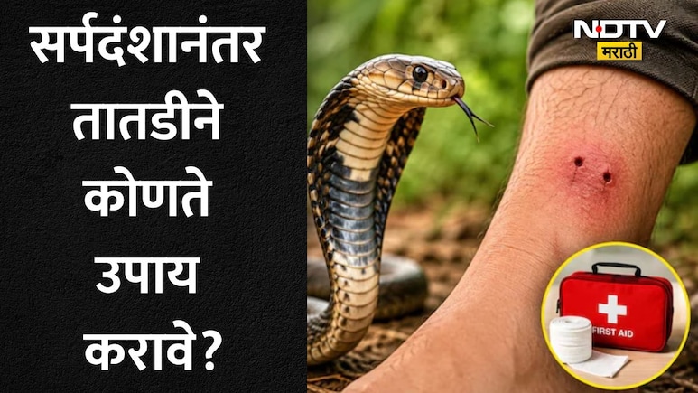 Snake Bite:सर्पदंशानंतर 10 मिनिटांची ही चूक ठरेल मृत्यूचे कारण, सर्वात आधी काय करावे? वाचा तज्ज्ञांचे 5 मुद्दे