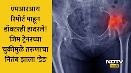 Shocking जिम ट्रेनरने 80,000 उकळले, इंजेक्शनमुळे रक्तपुरवठा थांबला अन् हाड सडलं; नितंबावर झाला हा गंभीर परिणाम