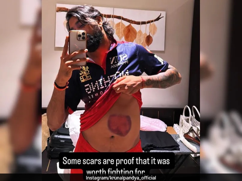 Krunal Pandya Shows His Battle Scars After Match-Winning 73 Against Mumbai Indians
