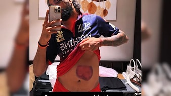 Krunal Pandya Shows His Battle Scars After Match-Winning 73 For RCB