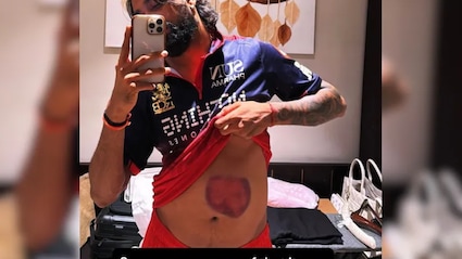 Krunal Pandya Shows His Battle Scars After Match-Winning 73 For RCB