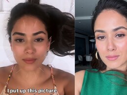 Mira Kapoor Swears By Cosmetic Acupuncture, Shares Benefits: 'Face Looks Incredibly Better'