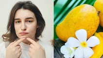 How To Enjoy Mangoes This Summer Without Worrying About Acne
