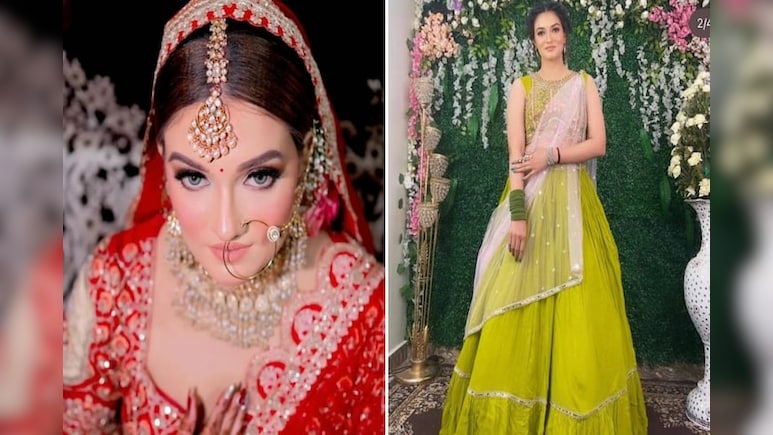 Chilling Details Emerge In Noida Dowry Death Case, Autopsy Reveals Multiple Injuries