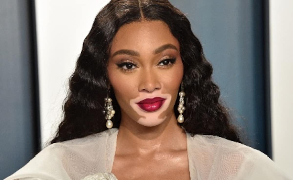 Winnie Harlow