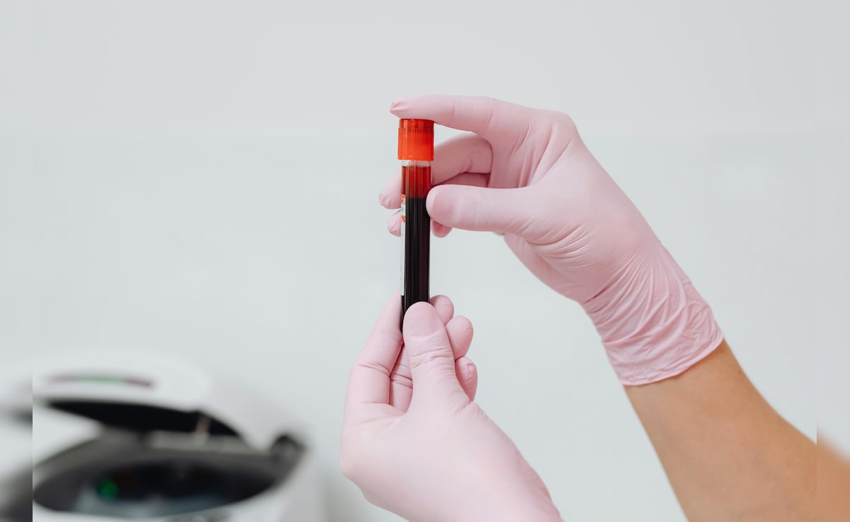VeloCD Blood Test: अब ब्लड टेस्ट से पहले ही चल सकेगा पता, बीमारी बढ़ेगी या मरीज जल्दी होगा ठीक!