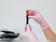 VeloCD Blood Test: अब ब्लड टेस्ट से पहले ही चल सकेगा पता, बीमारी बढ़ेगी या मरीज जल्दी होगा ठीक!
