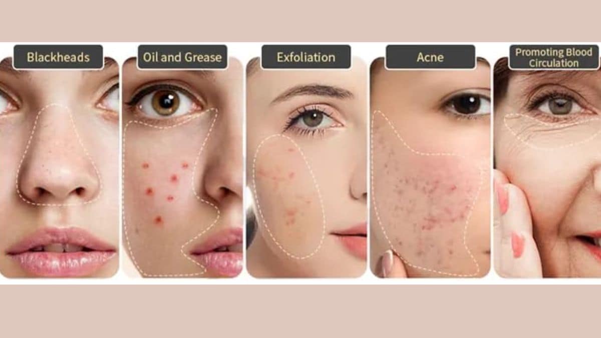 A beginners guide to using proper pore cleansing tools without causing any skin damage. A beginners guide to using proper pore cleansing tools without causing any skin damage.