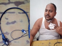 बिहार में गर्मी का कहर, बाईक चलाते युवक की गर्दन में फटा ब्लूटूथ ईयरफोन