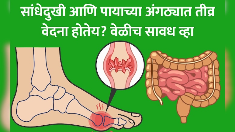 High Uric Acid Symptoms: युरिक अ&zwj;ॅसिड वाढलंय? युरिक अ&zwj;ॅसिड म्हणजे काय? जाणून घ्या लक्षणं आणि 5 रामबाण उपाय
