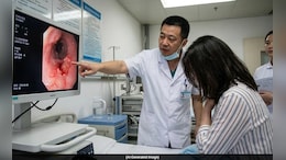 Woman Drinks Ice Water After Hotpot, Doctors Discover 8 Cm Ulcer In Throat