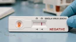 Ebola Scare In Gujarat Ruled Out After Traveller Tests Negative