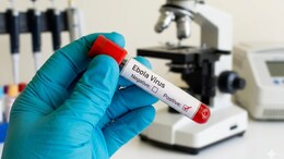Ebola Outbreak 2026: WHO Reports Nearly 500 Confirmed Cases And 84 Deaths Across Congo And Uganda