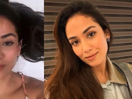 Mira Kapoor Claims Facial Acupuncture Tightens Skin, What A Delhi Dermatologist Says