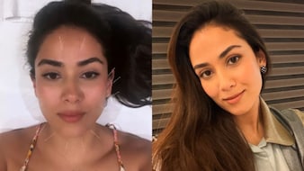 Mira Kapoor Claims Facial Acupuncture Tightens Skin, Dermatologist Weighs In