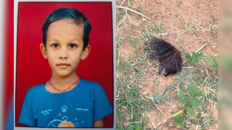 आवारा कुत्तों ने 9 साल को नोचा, खाल समेत अलग हुए सिर के बाल, हालत बेहद गंभीर