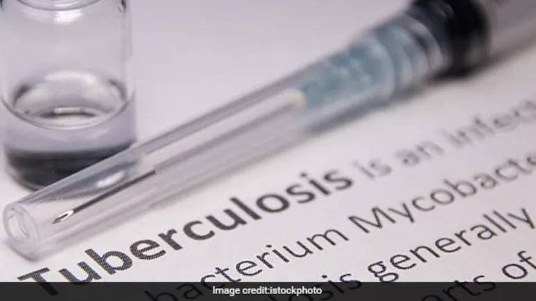शिमला के नर्सिंग हॉस्टल में फैली बीमारी, 19 छात्राएं टीबी ग्रसित, NHRC ने सरकार से मांगा जवाब