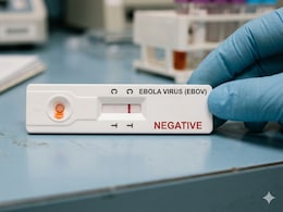 Second Sudanese National Admitted To Hyderabad Hospital Also Tests Negative For Ebola