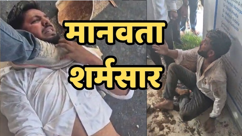 &nbsp;सूरत में मुस्लिम युवक की बेरहमी से पिटाई, गले पर पैर रखने का वीडियो वायरल; पुलिस को अब भी है शिकायत का इंतजार