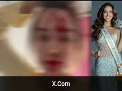 Miss Venezuela 2025 Shares Video Showing Injuries After Assault By Stylist